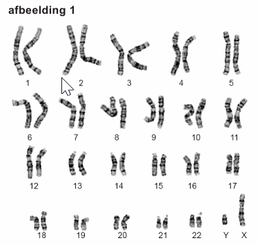 Bronafbeelding bij vraag 22